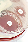Staphylococcus culture and antibiotics