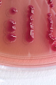 Acinetobacter baumannii bacterial culture