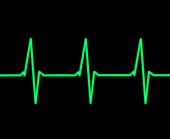 ECG heartbeat trace, illustration