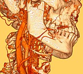 Neck blood vessels, illustration