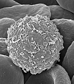 Leukaemia cell, SEM