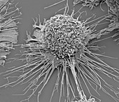 Activated macrophage, SEM