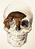 Homo antecessor fossil
