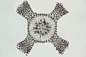 Radiolarian, light micrograph