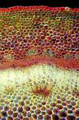 Forsythia sp. stalk, light micrograph