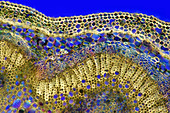 Peony (Paeonia sp.) stalk, light micrograph