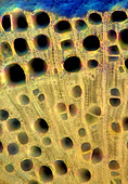 Cypress tree stalk, light micrograph