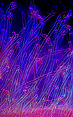 Radiator plant (Peperomia sp.) root hairs, light micrograph