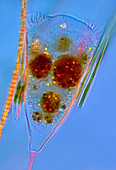 Suctorian protozoan and diatoms, light micrograph