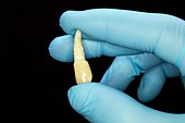 Extracted canine tooth with crown