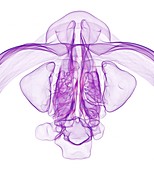 Paranasal sinuses and nose, 3D CT scan