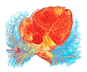 Human heart and lung bronchioles, 3D CT scan