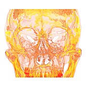 Facial bones of the skull, 3D CT scan