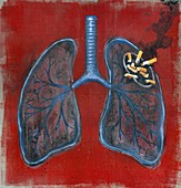 Illustration of lungs and cigarettes