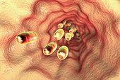 Medicines in oesophagus, illustration