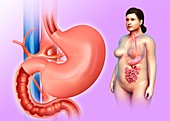 Female stomach and duodenum, illustration