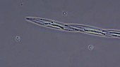 Diatom chain, light microscopy footage