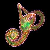 Inner ear structures, 3D MRI scan