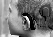 Boy fitted with cochlear implant