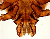 Brown dog tick mouthparts, light micrograph