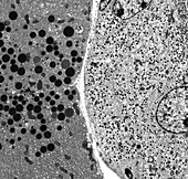 Pancreatic cells, TEM