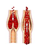 Valve mechanism in veins, illustration