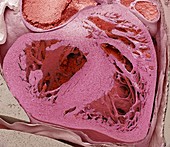 Mouse embryo heart, SEM