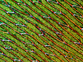 Bryum moss leaf, light micrograph