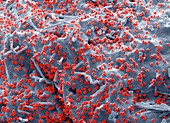 HIV infected 293T cell, SEM