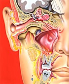 Middle ear, tooth and sinus infections, illustration