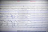 Brain waves recorded on an EEG