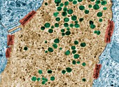 Secretory cell with desmosomes, TEM