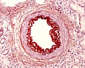 Renal muscular artery, light micrograph