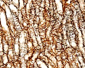 Kidney medulla, light micrograph