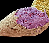 Cell lysis, SEM