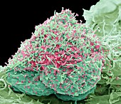 HIV infected cell, SEM