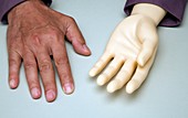 Artificial hand and human hand