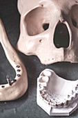 Dental prosthesis and jaw with skull