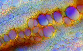Fern stem, light micrograph