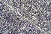 Liverleaf (Hepatica sp.) petal, light micrograph