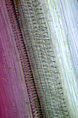 Liverleaf (Hepatica sp.) stem, light micrograph
