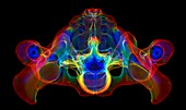 Pelvis and lumbar spine, 3D CT scan