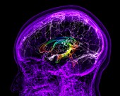 Human skull and brain, 3D MRI scan