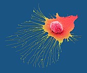 Migrating breast cancer cell, SEM