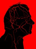 Vascular head disorders, conceptual image
