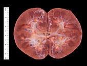 Macro section of a normal human kidney