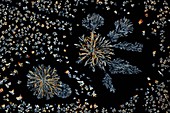 Glutamine crystals, light micrograph