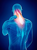 Person with neck pain, illustration