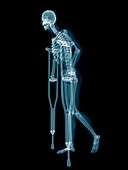 Skeletal system of someone on crutches, illustration