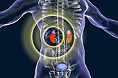 Treatment of kidney disease, illustration